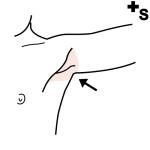 Arasaac 150-724c84ab6a02eab5f49756b6a344cd5e